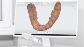 Что такое стоматологическое сканирование?