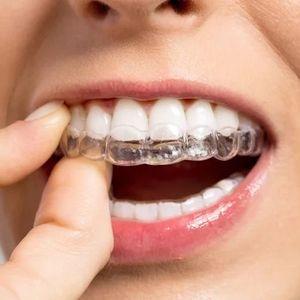 אורתודנטיה - יישור שיניים